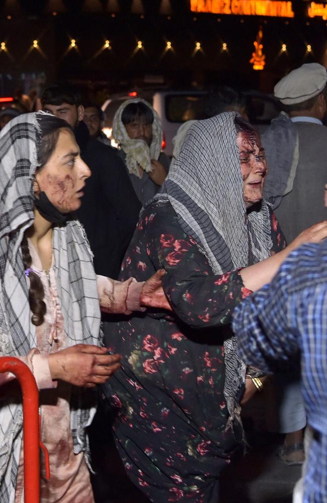 Wounded women arrive at a hospital for treatment after the blasts. Picture: Wakil Kohsar / AFP)
