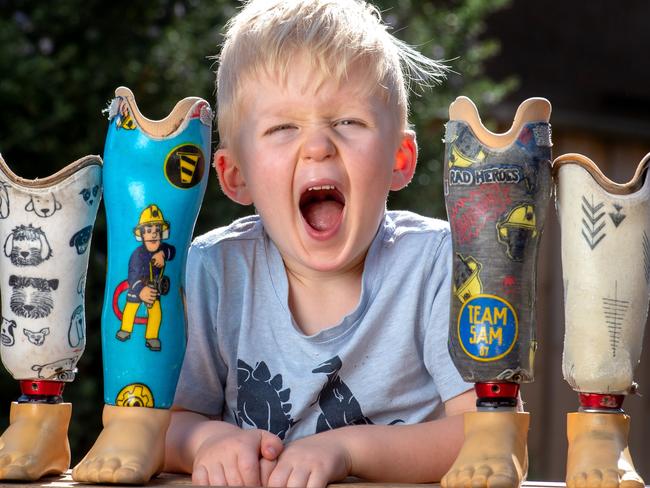 Ollie Wedding with some of the prosthetic legs he has outgrown. Pictures: Jay Town