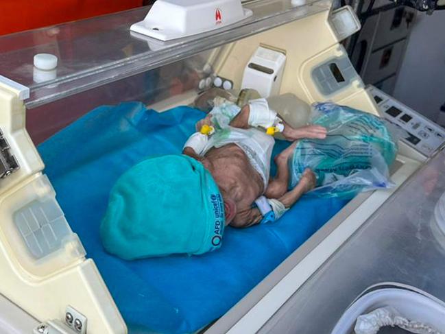 A premature Palestinian baby evacuated from Gaza is pictured inside an ambulance on the Egyptian side of the Rafah border crossing with the Gaza Strip. Picture: AFP