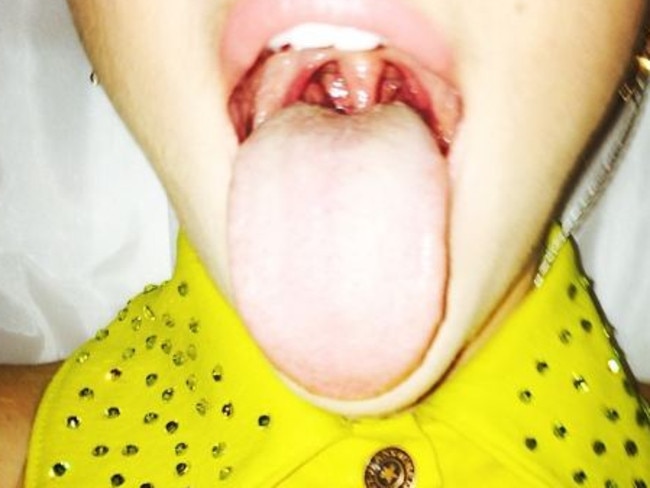 Miley mouthed ... Cyrus posted a strange mouth picture after a show in Finland. Credit: Instagram