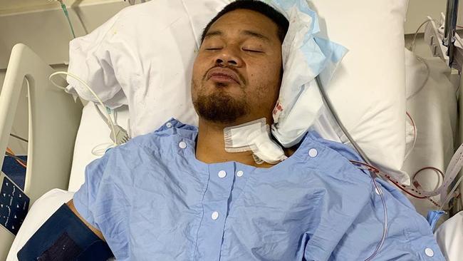 Joey Leilua underwent delicate and life-changing spinal surgery.