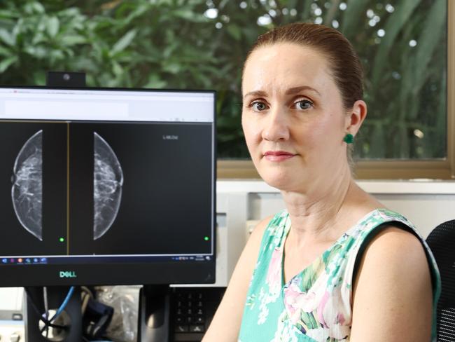 Queensland X Ray will no longer provide breast mammography, imaging or biopsy services to Cairns patients, halving the number of screening services available and causing delays that could place some patients at risk. Surgeon Dr Aemelia Melloy specialises in breast surgery and is concerned that the inevitable delays caused by the lack of screening options will place her patients at significant risk. Picture: Brendan Radke