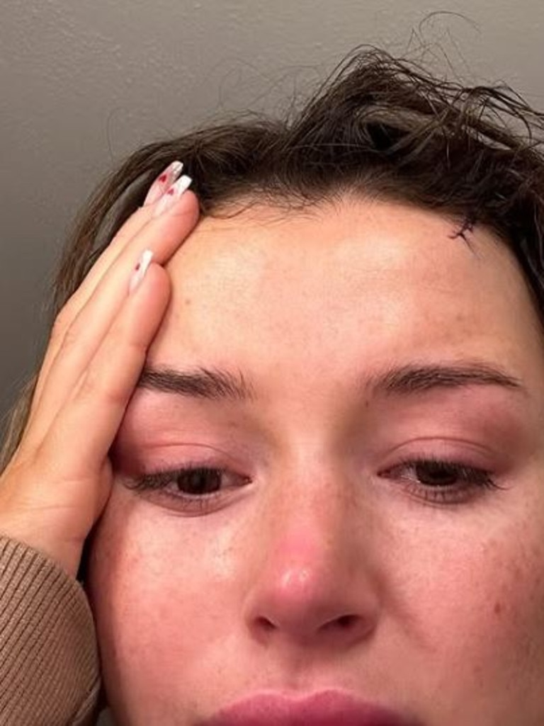 She relived the assault two years on. Picture: Instagram/charleenmurphy