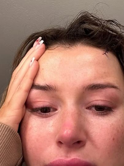 She relived the assault two years on. Picture: Instagram/charleenmurphy