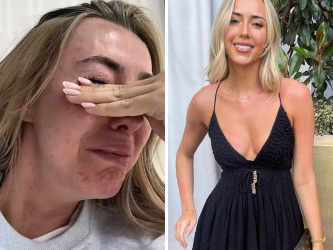 CEO in tears over man comments