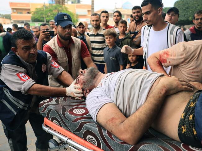 An injured Palestinian man is rushed into the Al-Aqsa Hospital following the Israeli bombardment of in Deir el-Balah, in the central Gaza Strip. Picture: AFP