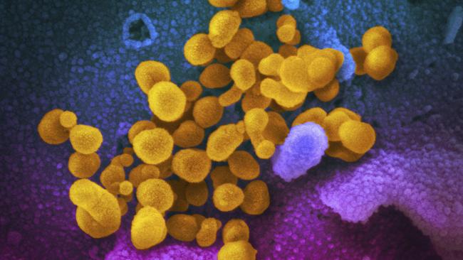 A microscope view of the novel coronavirus SARS-CoV-2. Picture: AP