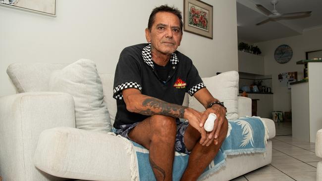 Darwin man Mark Davis is lucky to be alive after contracting melioidosis while watering his garden. Picture: Pema Tamang Pakhrin