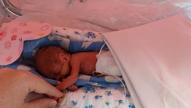 Premature baby Evelyn (Evie) Olave, an identical twin with her sister Genevieve, was born at Mater Hospital in November 2020 at 23 weeks and one day gestation. Evie is pictured the day after her birth.