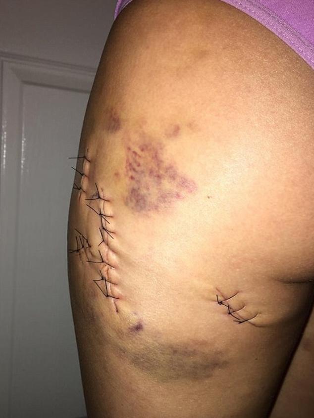 Dr Angela Jay was stabbed 11 times and doused in petrol by a stalker. Picture: Instagram