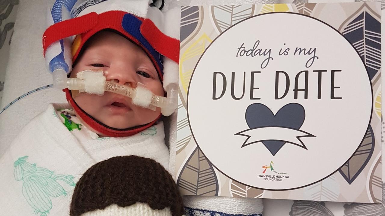 Jack Downes was born at 34 weeks old, with his family travelling for months between Mount Isa and Townsville before he was transferred to hospital in Brisbane.