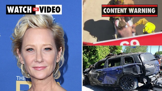 Anne Heche Ellen Degeneres Ex Girlfriend Severely Burned After La Crash Herald Sun 0967