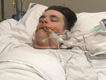 Bailey Alcock, 16, was stabbed in his street, Benelong Place, Kincumber, on Monday 26th April, at 1pm., , On call firefighter Peter Kersenboom has confirmed picture. , , , https://www.facebook.com/groups/503779763944201