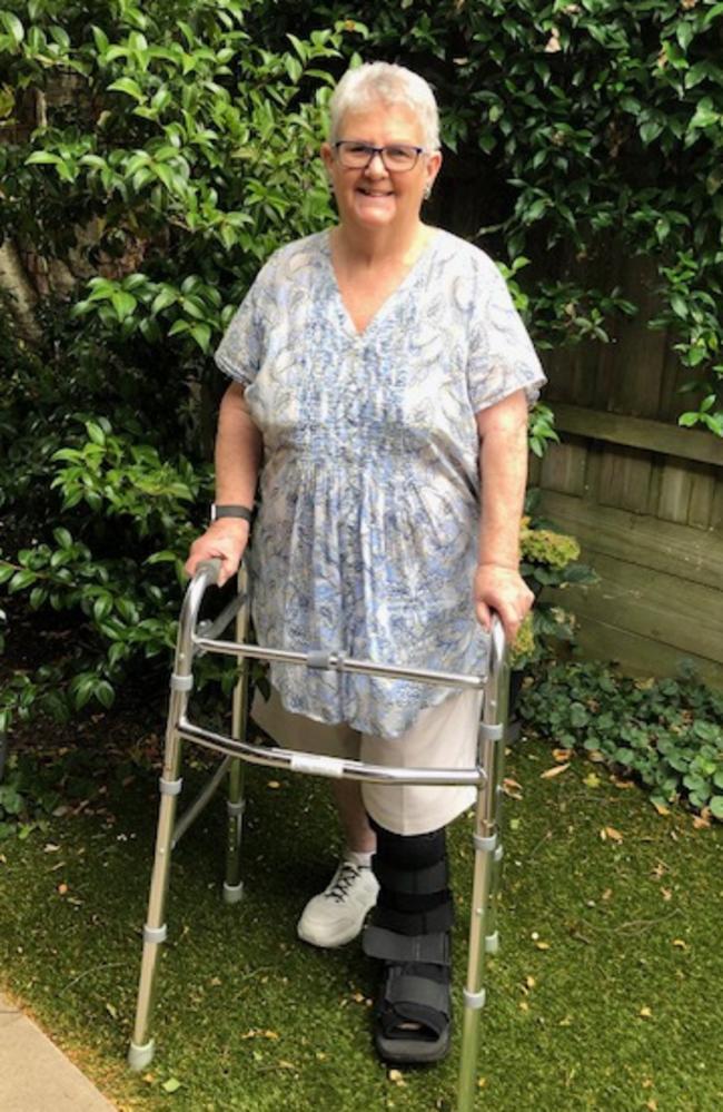 Retired nurse Anne Leonard paid $1000 in out of pocket fees for her ankle surgery, then her specialist charged her $800 for post operative care which she could not claim on Medicare. Picture: Supplied