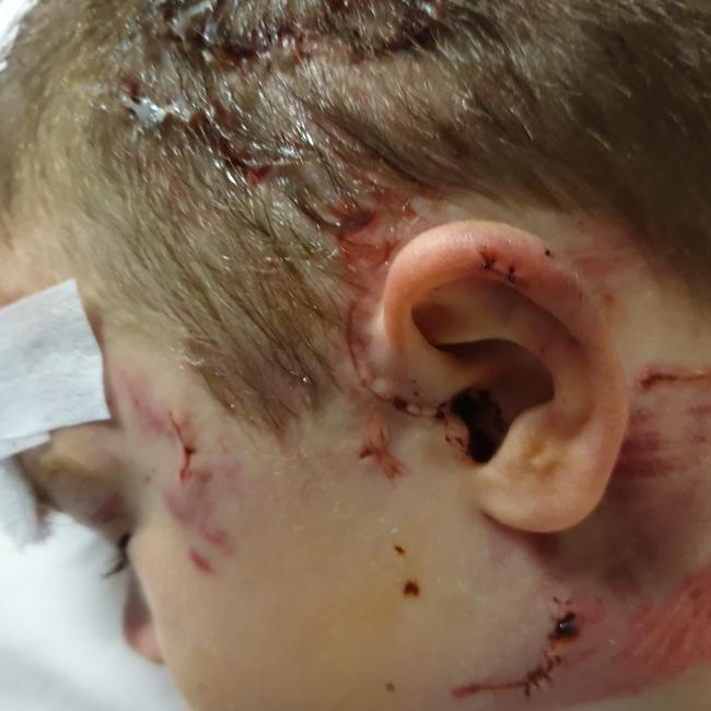 Riquel Hayden says Caolan almost had his ear ripped off during the attack, which missed his jugular by millimetres.