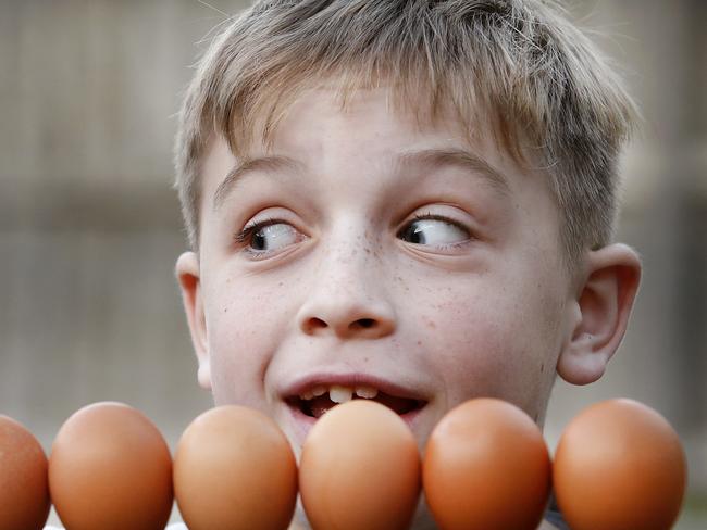 An immunotherapy treatment, which has shown long-lasting effects against peanut allergy where participants were given a probiotic together with peanut protein, is now being extended to eggs. Jamie Stevenson 9, who is under immunotherapy treatment for egg allergy, is excited about being able to finally eat eggs after treatment.    Picture: David Caird