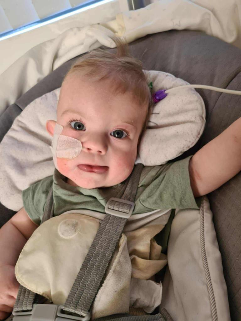 Despite the condition, he is a happy baby. Picture: Supplied
