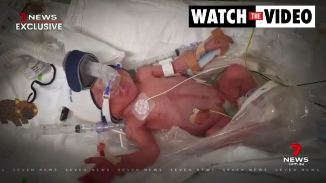 COVID-19 leaves parents unable to see premature baby (7 News)