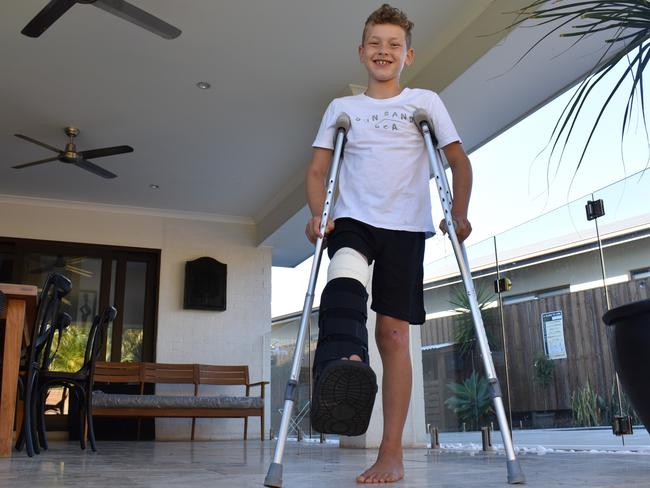 Bryson, 8, was hit by a car when crossing the road at Casuarina. Picture: Liana Walker