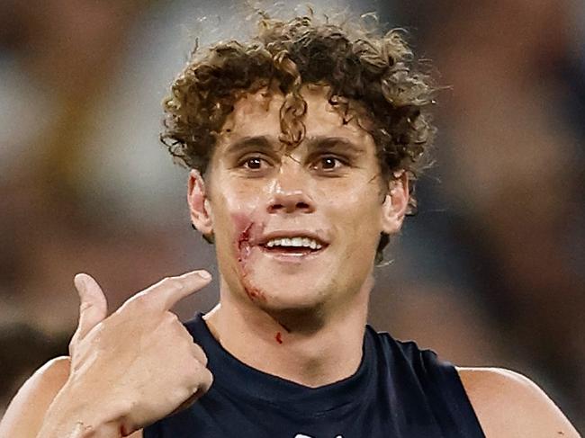 MELBOURNE, AUSTRALIA - MARCH 14: Charlie Curnow of the Blues gestures at a cut on his face during the 2024 AFL Round 01 match between the Carlton Blues and the Richmond Tigers at the Melbourne Cricket Ground on March 14, 2024 in Melbourne, Australia. (Photo by Michael Willson/AFL Photos via Getty Images)