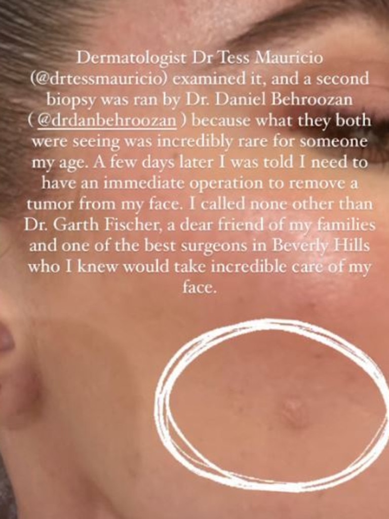 Kardashian said that after two biopsies, she was urged to undergo an ‘immediate operation’. Picture: Instagram