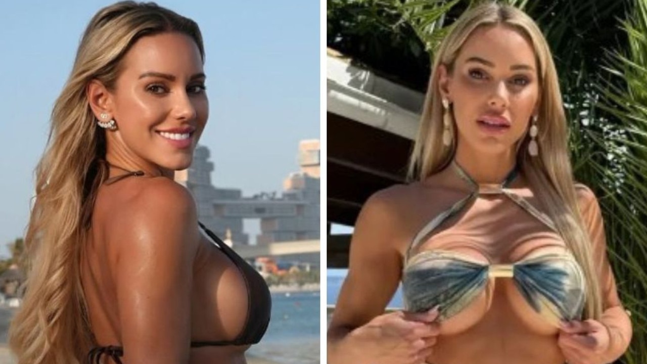 ‘Really bad’: 32yo’s horror pool party warning