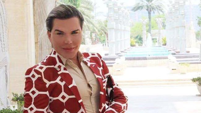 Rodrigo Alves has had more surgery. Picture: Rodrigo Alves/Instagram