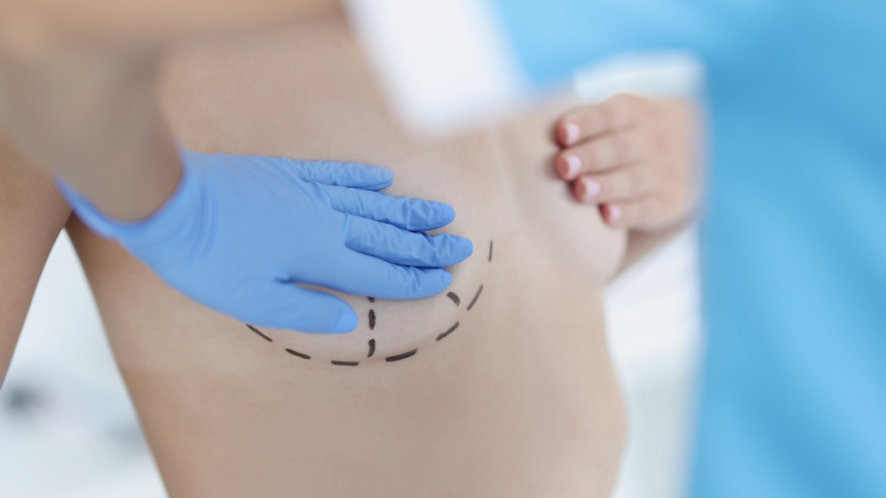 Nipple tattoos for mastectomy: how these 3D tattoos make women feel whole again