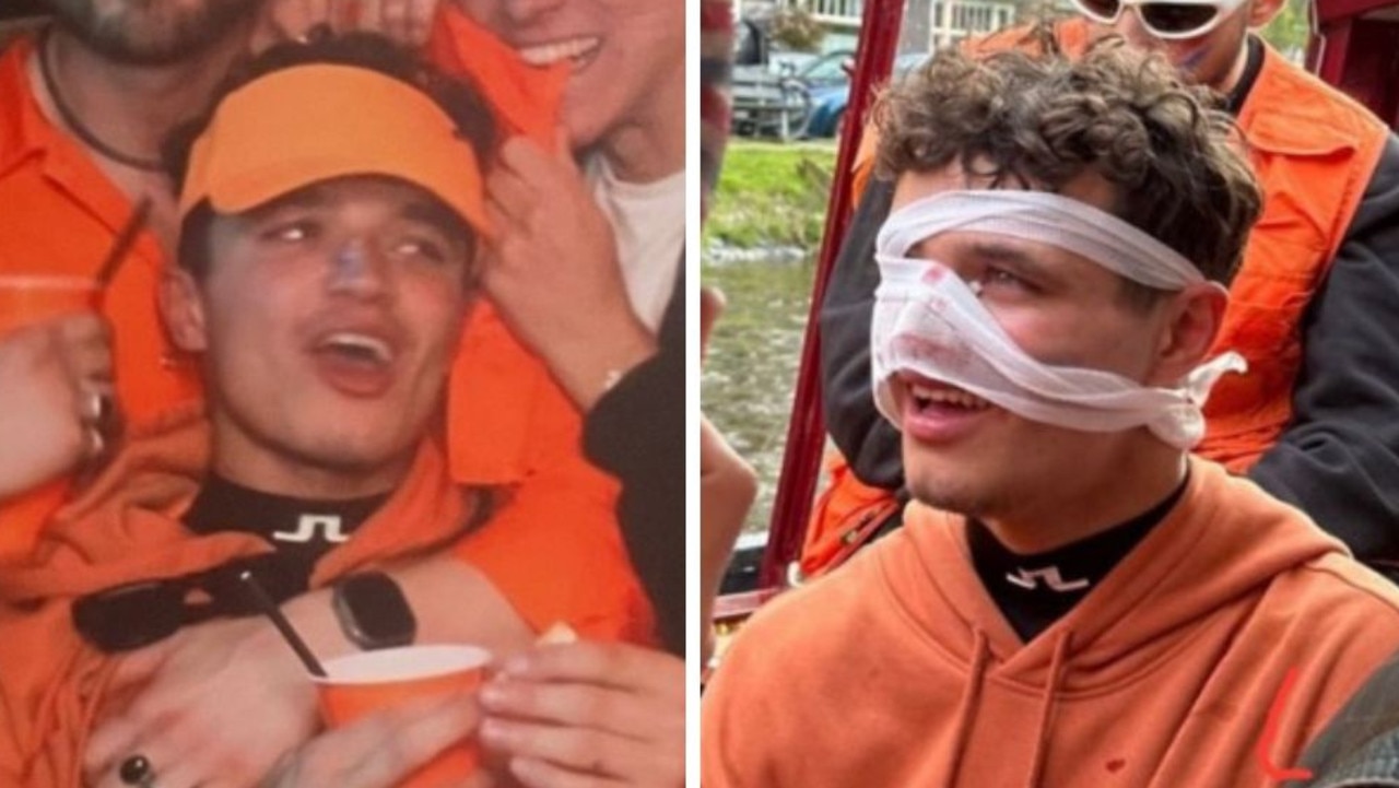 F1 driver Lando Norris gets injured partying in Amsterdam