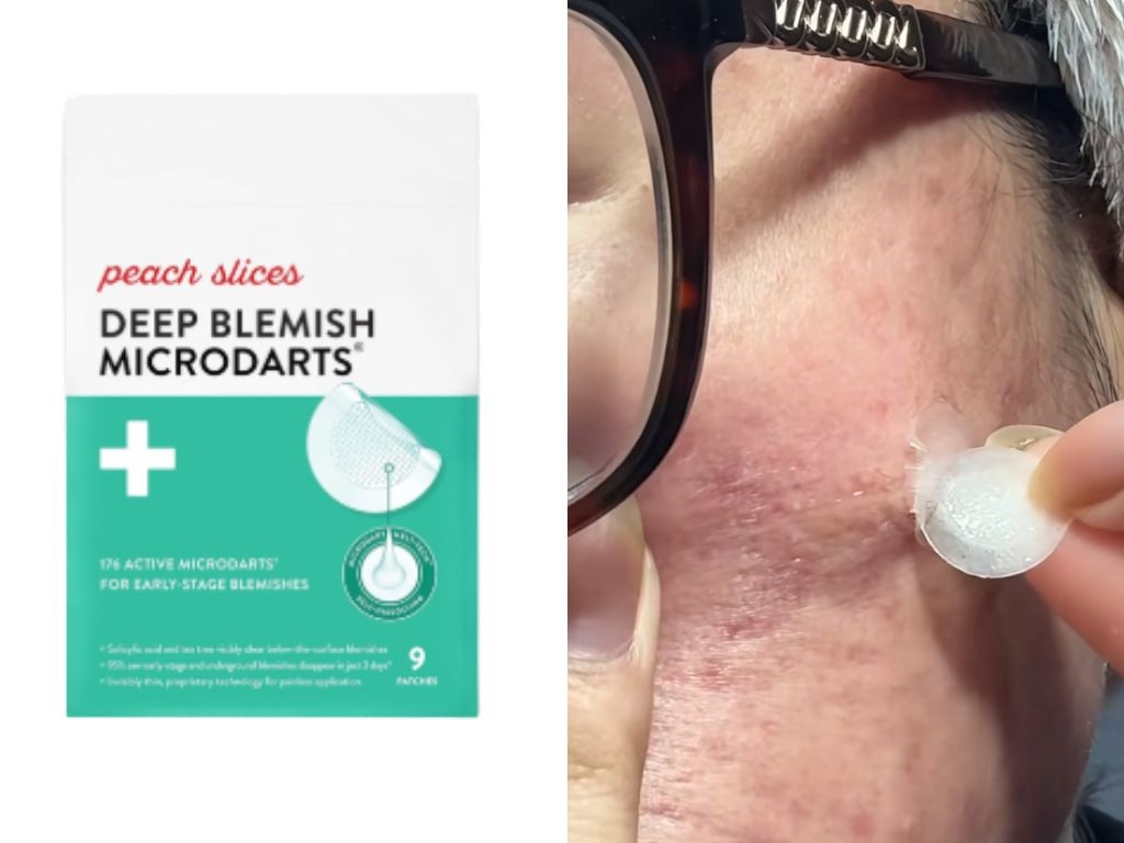 These Peach Slices pimple patches use tiny microdarts that dissolve into the skin to takle breakouts before they fully form. Picture: Supplied/Amazon, TikTok/@Jennilee