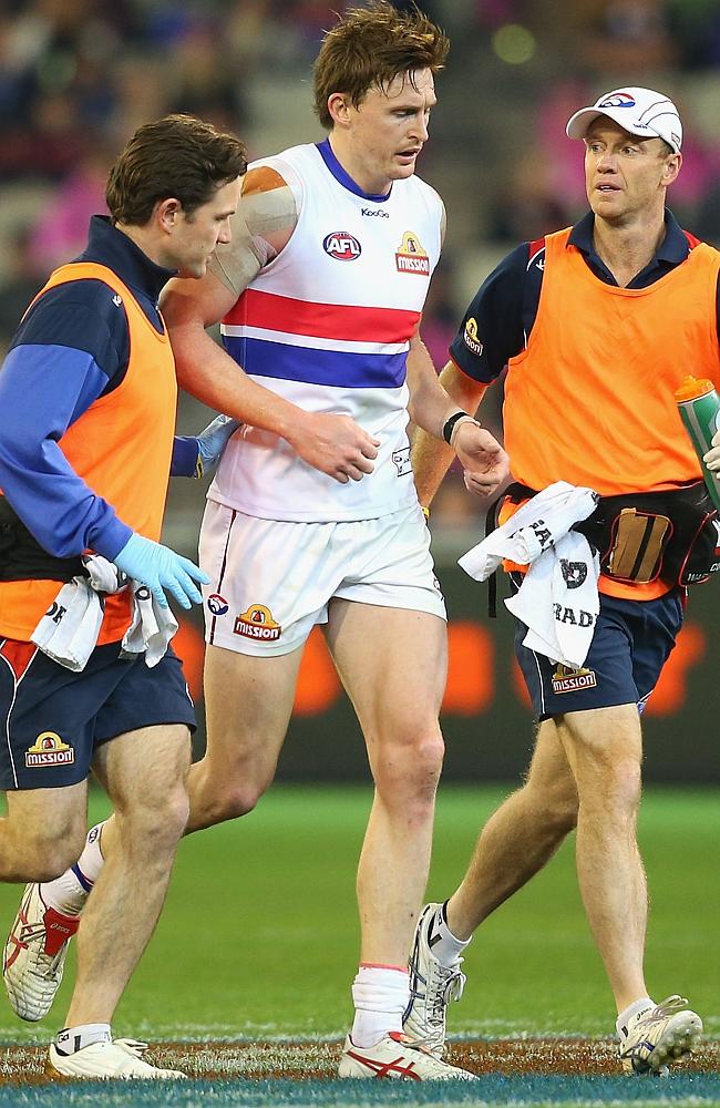 Tom Williams is helped from the ground after hurting his calf. Picture: Getty