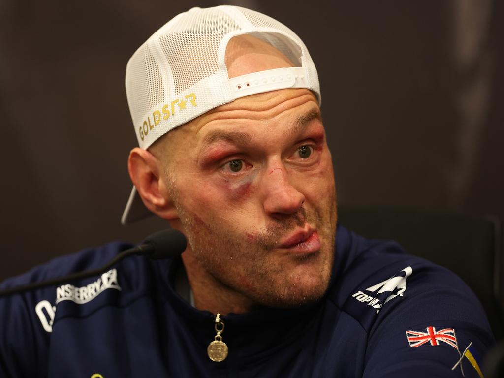 Some fight fans joked Fury seemed to be still rocked from his ninth round knockdown.