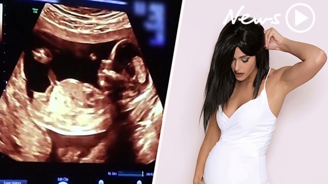 Kylie Jenner documents the moment she gives birth