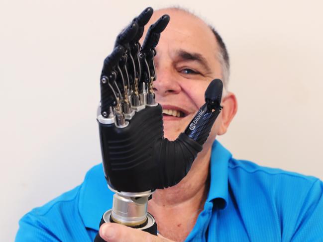 ‘Like a new toy’: Cairns man first in state to get myoelectric arm