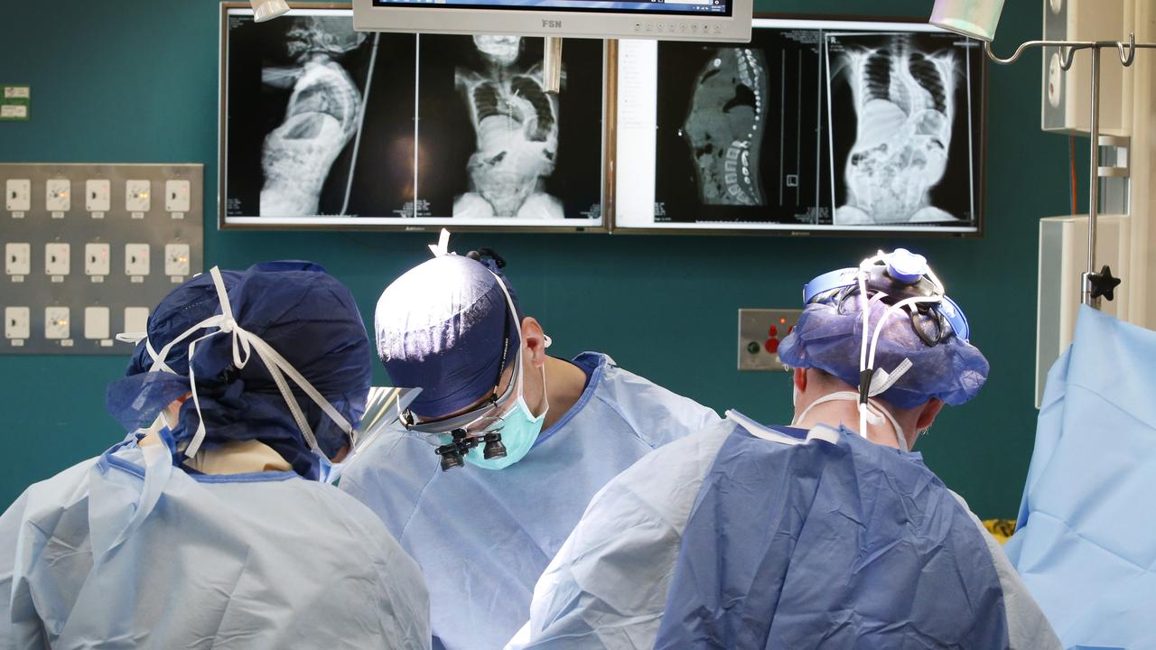 Surgeons working on Abubakir’s spine with X-rays showing the bend. Picture: David Caird