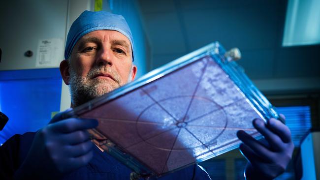 Burns surgeon Dr John Greenwood with a cassette containing a composite cultured skin at the Royal Adelaide Hospital in 2017. Picture: Tom Huntley