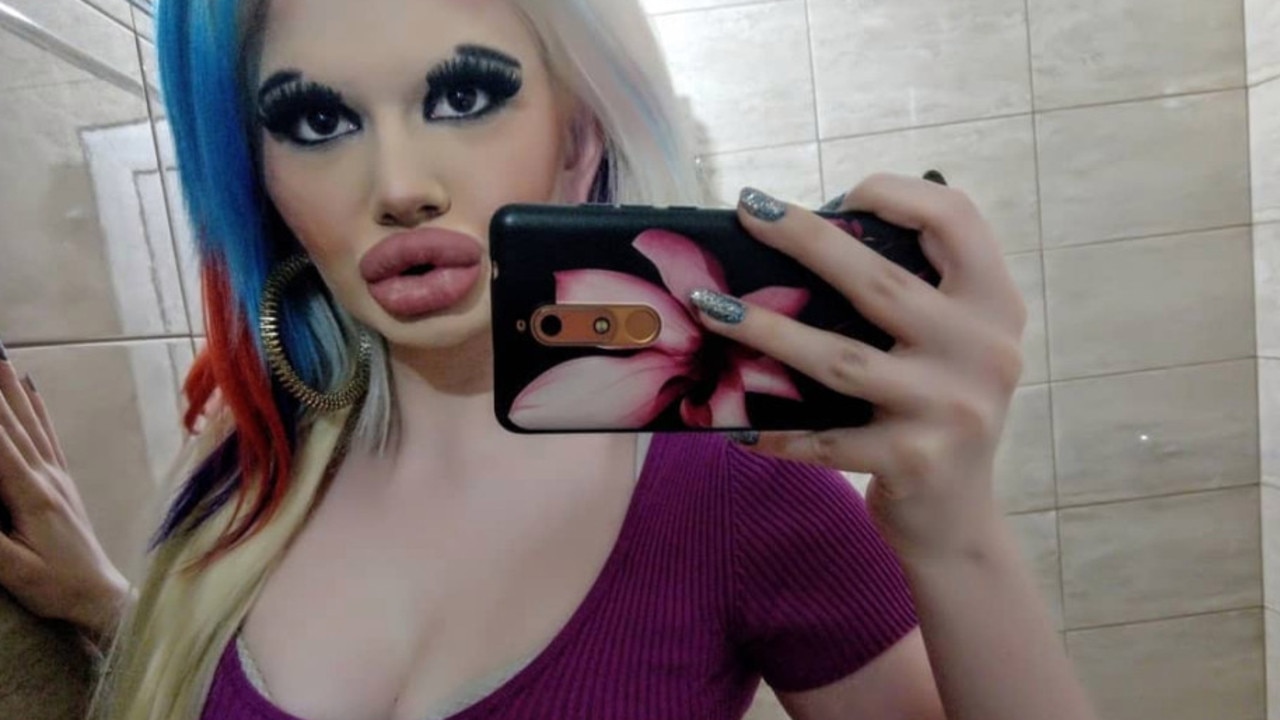 The philosophy student said she wanted to have the biggest lips in the world. Picture: Jam Press