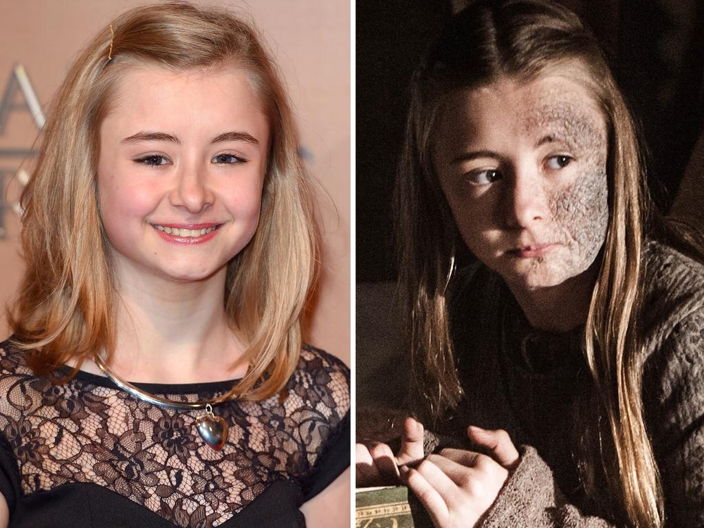 Kerry Ingram as character Shireen Baratheon. Picture: Getty/HBO