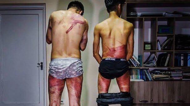 Two of the former embassy guards show the results of a beating they were given by the Taliban because they had worked for Australia. Picture: Supplied