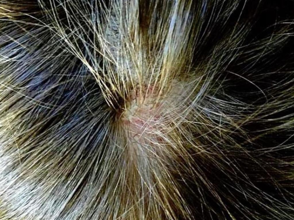 Amber Heard was left with a hole in her scalp after being repeatedly punched in the back of the head, she said. Picture: Fairfax County Court