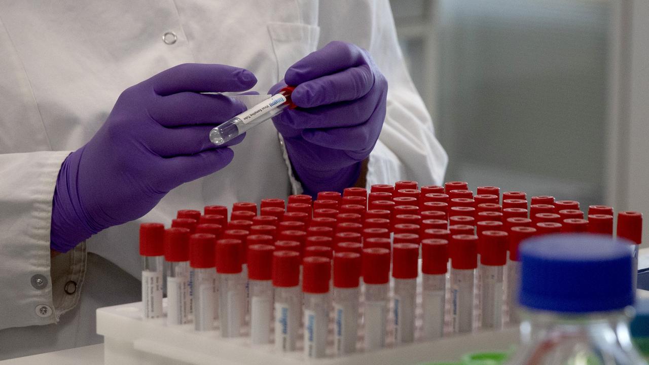 Researchers all over the world are working together to try and find treatments and a vaccine for COVID-19. Supercomputers are being used to speed up this effort. Picture: Virginia Mayo/AP