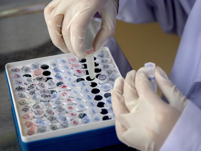 An employee works in a research and development lab of Beijing Applied Biological Technologies, a firm which is developing COVID-19 molecular diagnostic test kits, during a government organized tour for journalists in Beijing, Thursday, May 14, 2020. China reported three new coronavirus cases Thursday while moving to reopen for business and schools. (AP Photo/Mark Schiefelbein)