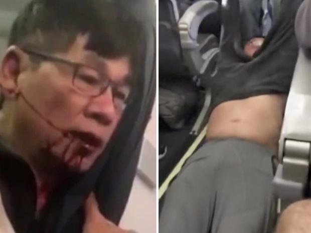 David Dao - United Airlines passenger removed from flight. Picture: AP