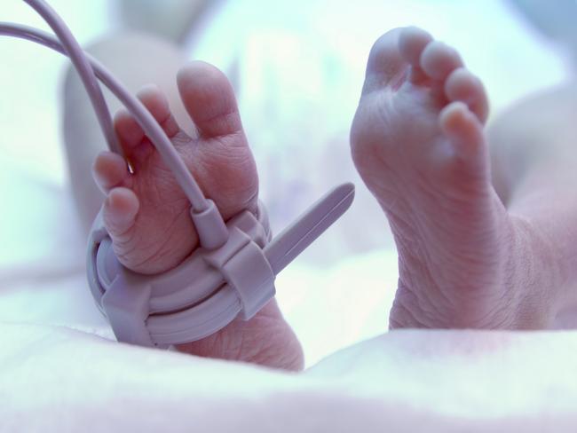 Feet of new born baby under ultraviolet lamp in the incubator. iStock Image - Generic