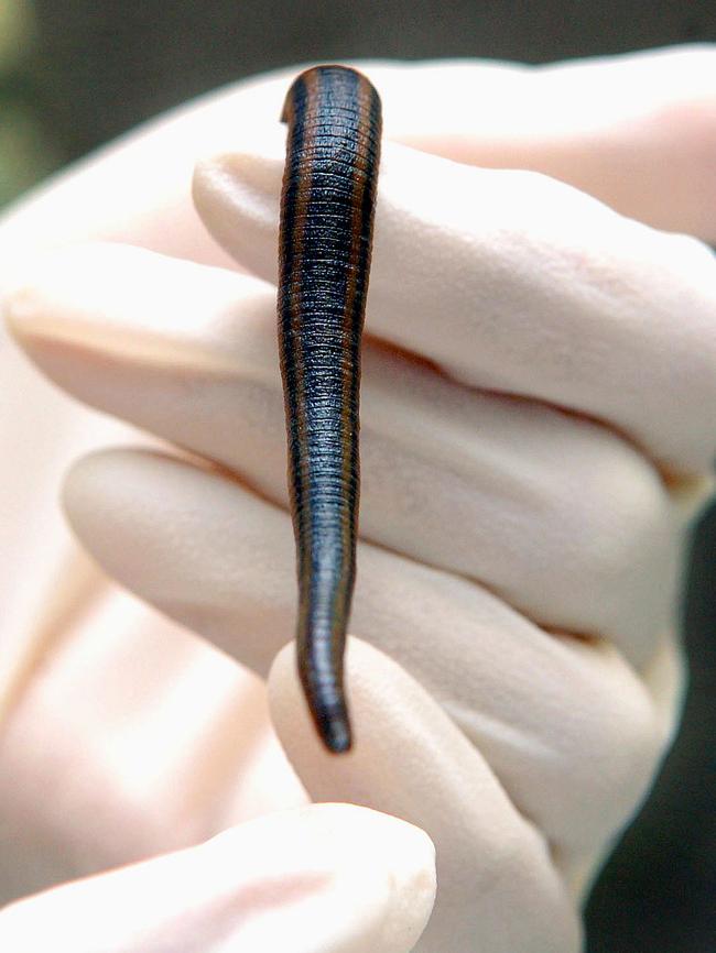 Medical leeches have been used in medicine for many years.