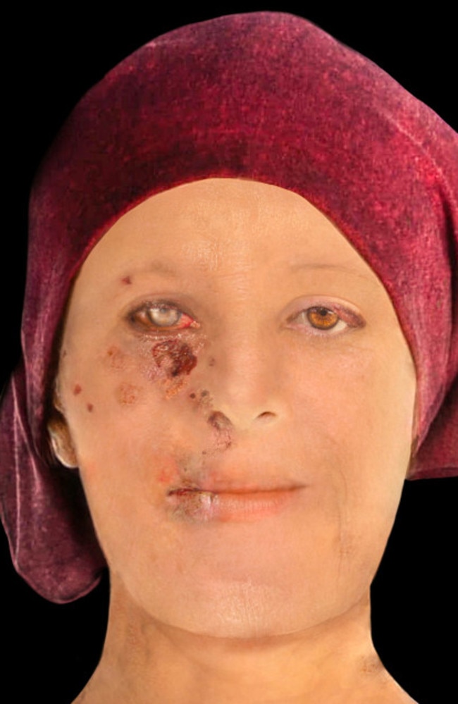 Leper woman in Scotland has face reconstructed | Herald Sun