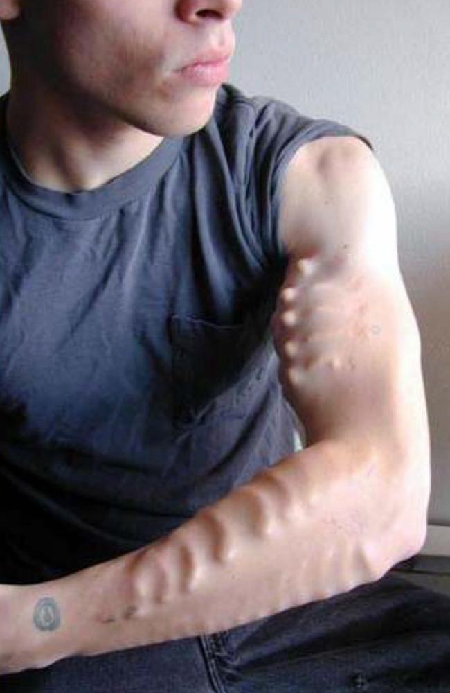 A person with silicon body moulds.