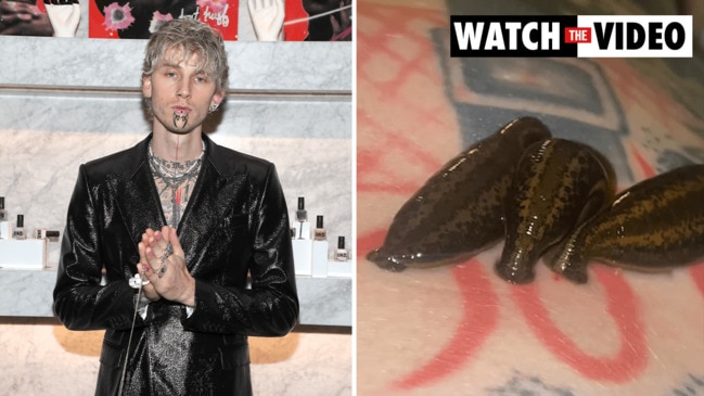 Machine Gun Kelly posts gruesome leech-sucking video