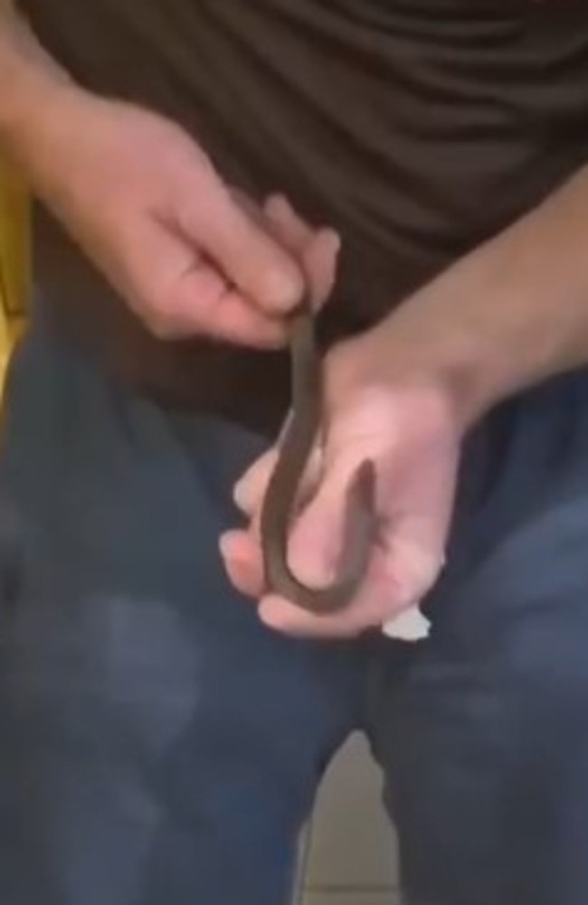 A Toowoomba man has recounted the moments after he was bitten by a what he thought was a 