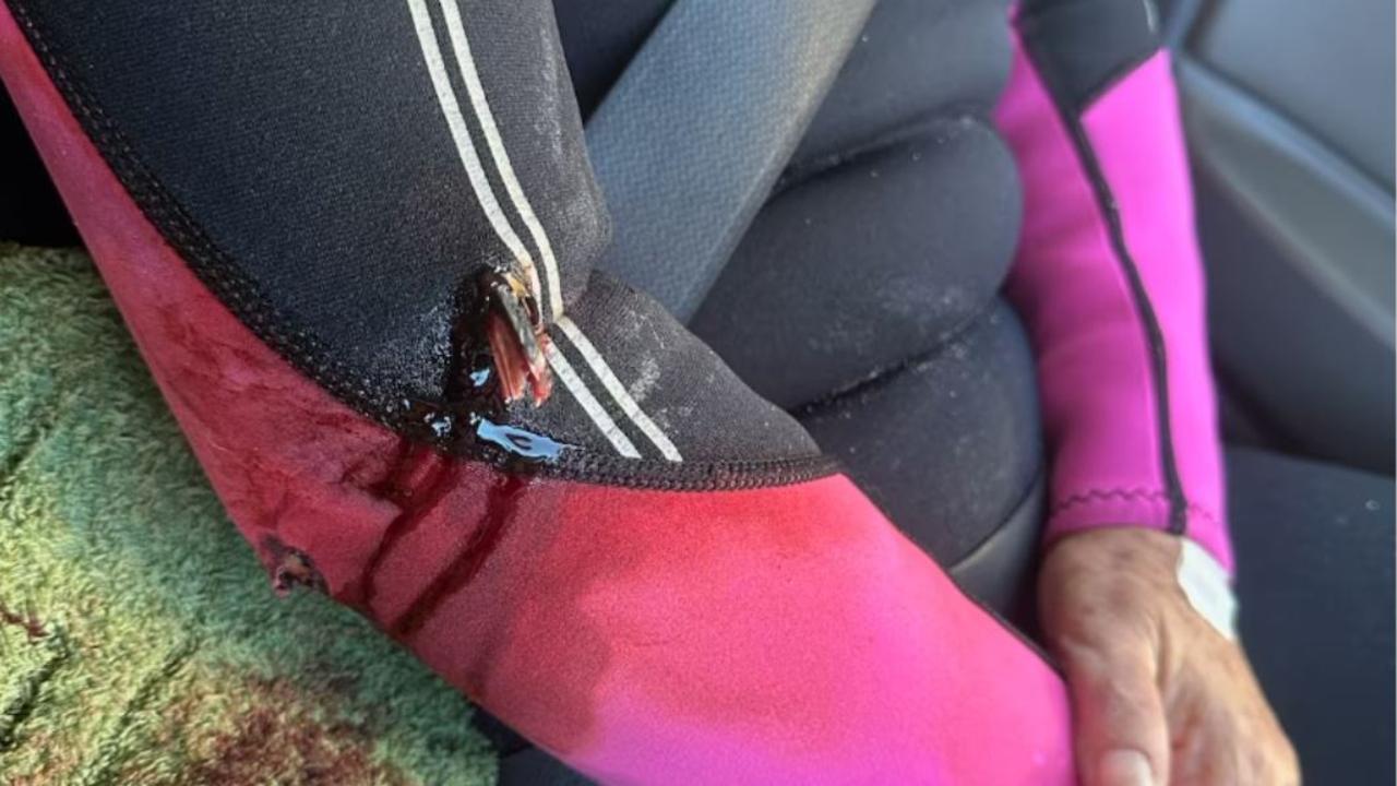 Pam Bennett told the ABC that although she “quickly swam out of the way”, she soon felt a 16cm barb go into her arm. Picture: Supplied